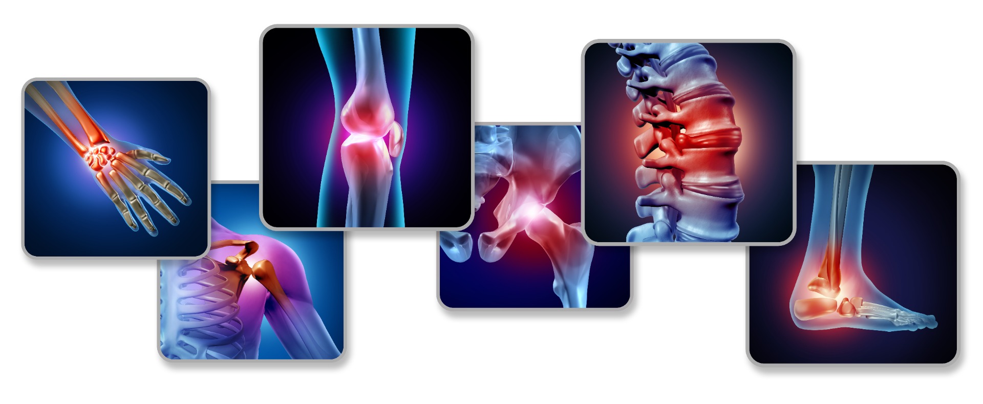 Lesiones Articulares :: Dr. Luis Manuel Riquelme